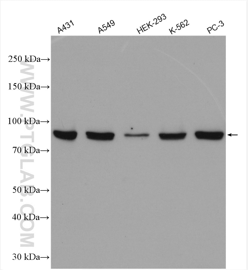 Western Blot (WB) analysis of various lysates using STAT1 Polyclonal antibody (10144-2-AP)