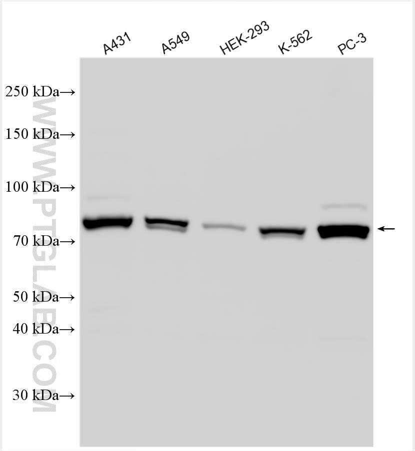 Western Blot (WB) analysis of various lysates using STAT1 Polyclonal antibody (10144-2-AP)