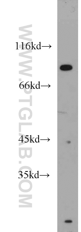 STAT1 Polyclonal antibody