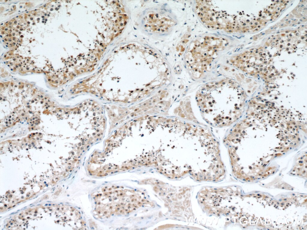 Immunohistochemistry (IHC) staining of human testis tissue using STAT1 Polyclonal antibody (51117-1-AP)