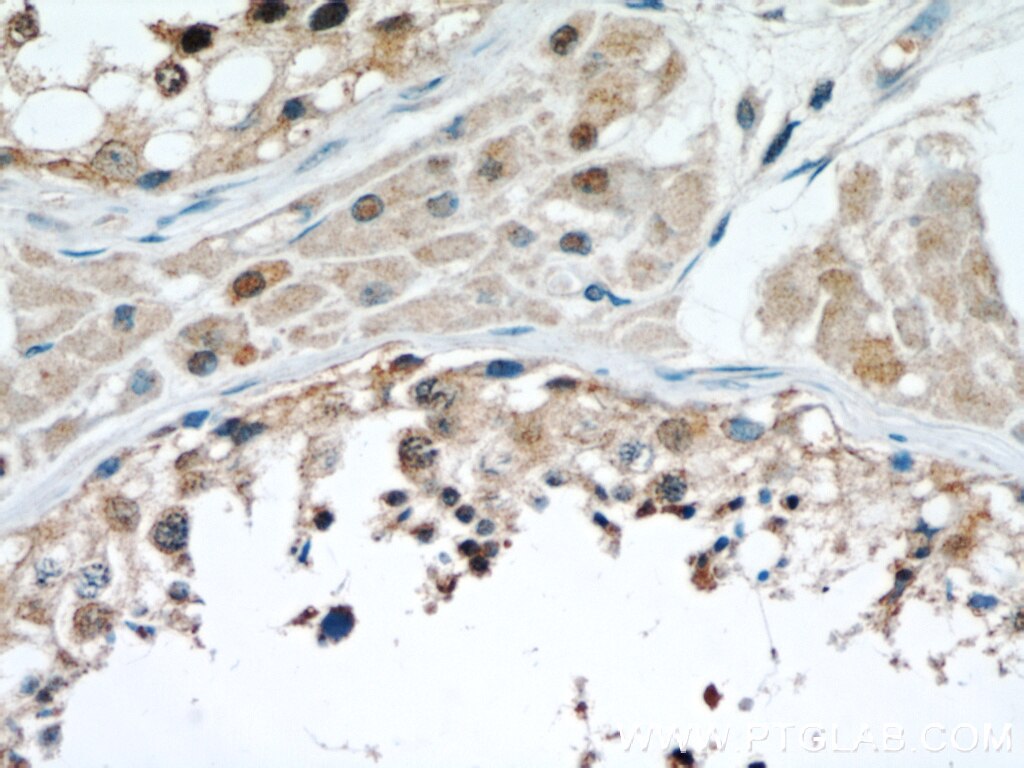 Immunohistochemistry (IHC) staining of human testis tissue using STAT1 Polyclonal antibody (51117-1-AP)