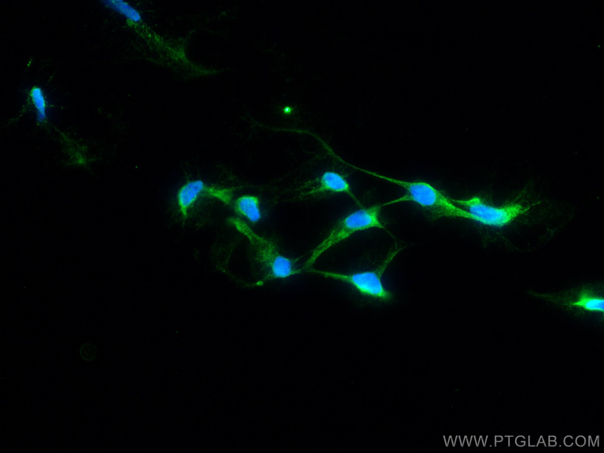 Immunofluorescence (IF) / fluorescent staining of HEK-293 cells using STAT1 Monoclonal antibody (66545-1-Ig)