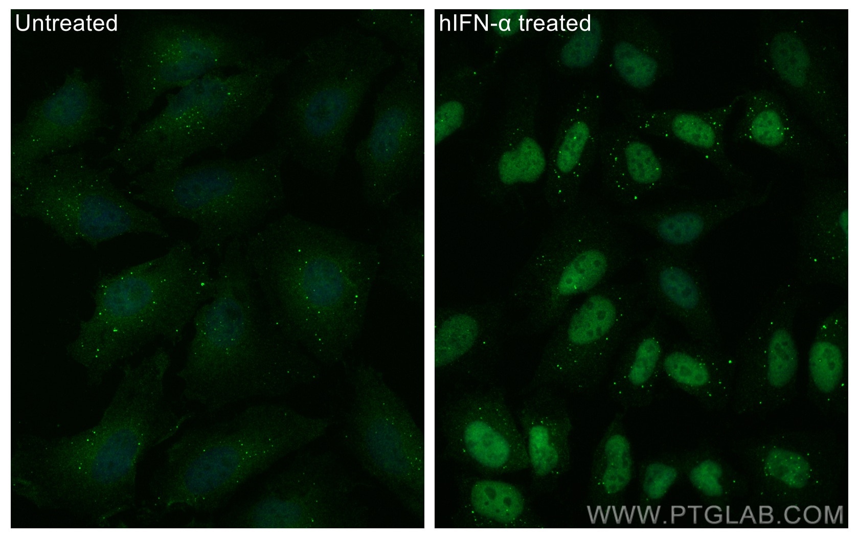Immunofluorescence (IF) / fluorescent staining of HeLa cells using STAT1 Monoclonal antibody (66545-1-Ig)