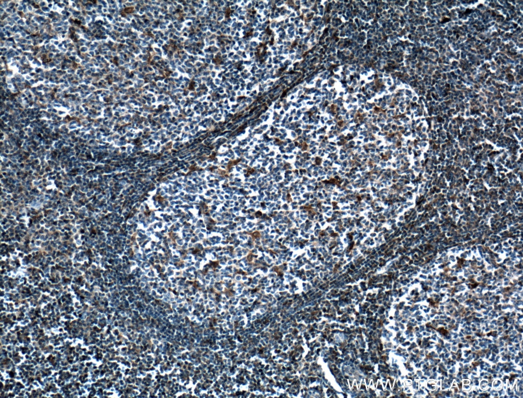 Immunohistochemistry (IHC) staining of human tonsillitis tissue using STAT1 Monoclonal antibody (66545-1-Ig)