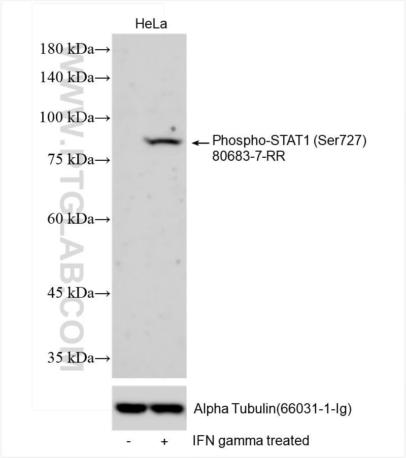Western Blot (WB) analysis of various lysates using Phospho-STAT1 (Ser727) Recombinant antibody (80683-7-RR)