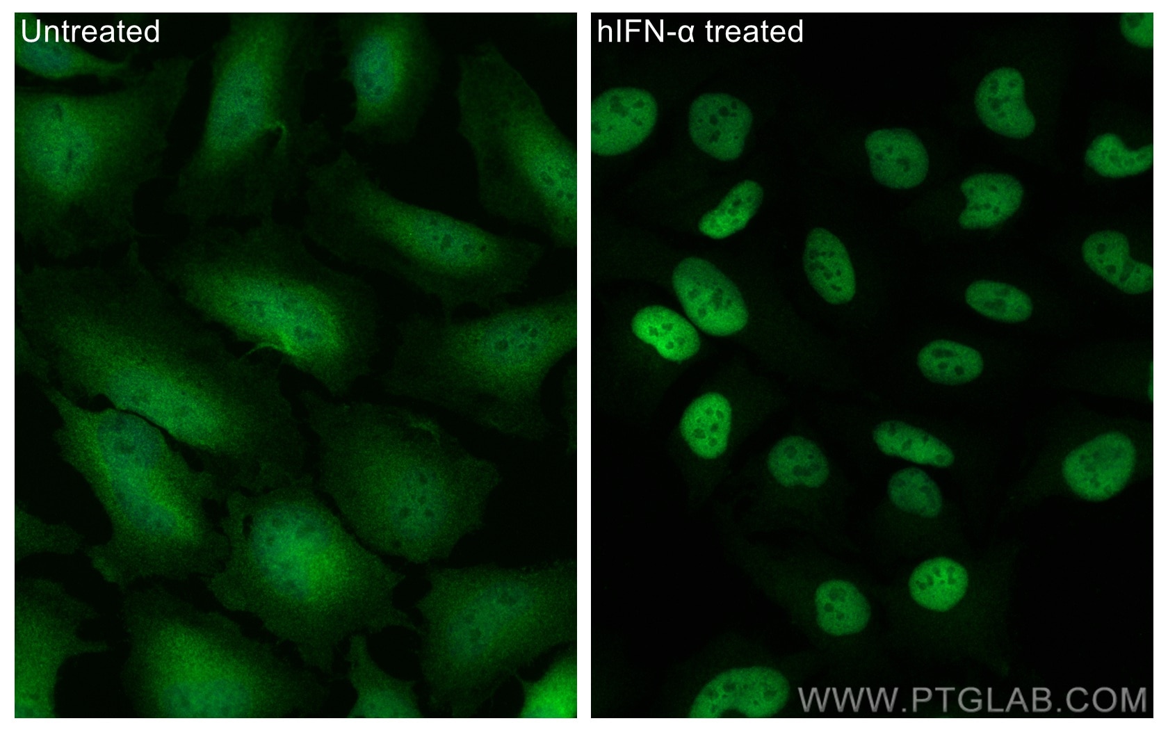 Immunofluorescence (IF) / fluorescent staining of HeLa cells using STAT1 Recombinant antibody (82016-1-RR)