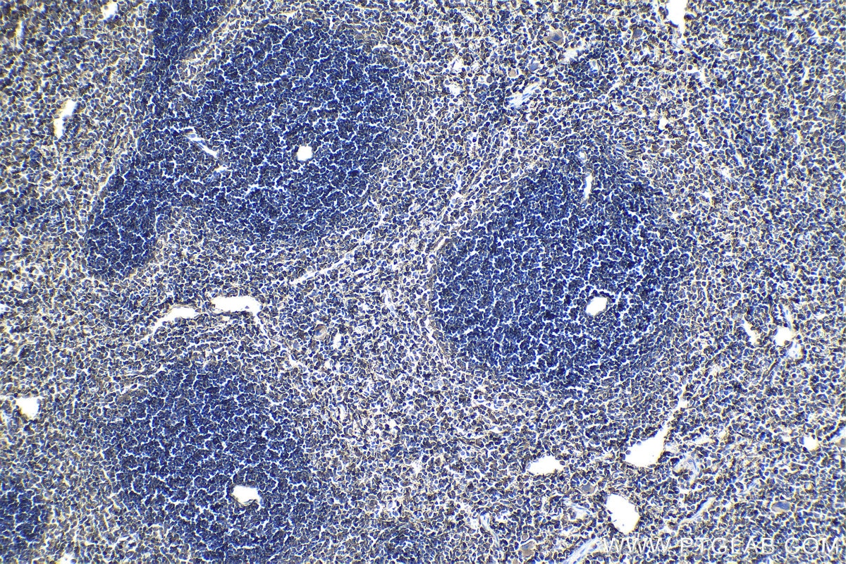 Immunohistochemistry (IHC) staining of mouse spleen tissue using STAT1 Recombinant antibody (82016-1-RR)