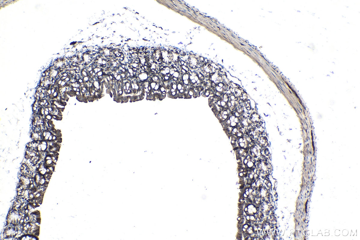 Immunohistochemistry (IHC) staining of mouse colon tissue using STAT1 Recombinant antibody (82016-1-RR)