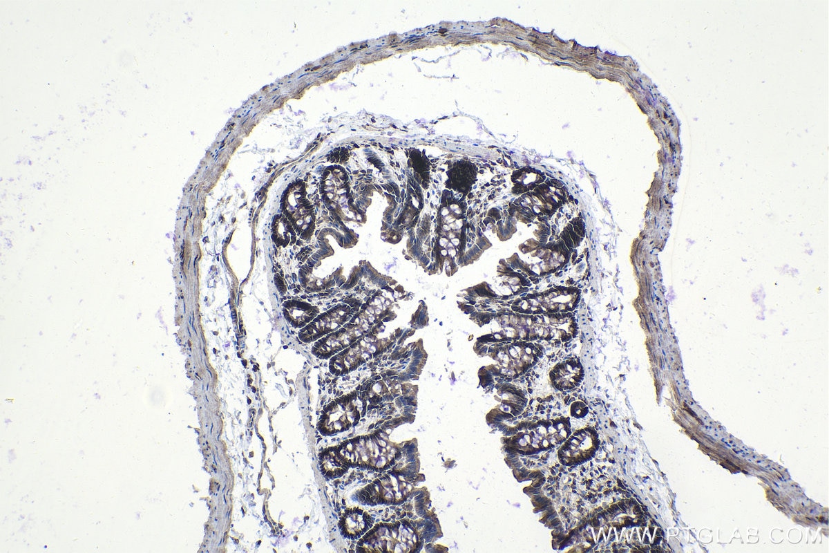 Immunohistochemistry (IHC) staining of rat colon tissue using STAT1 Recombinant antibody (82016-1-RR)