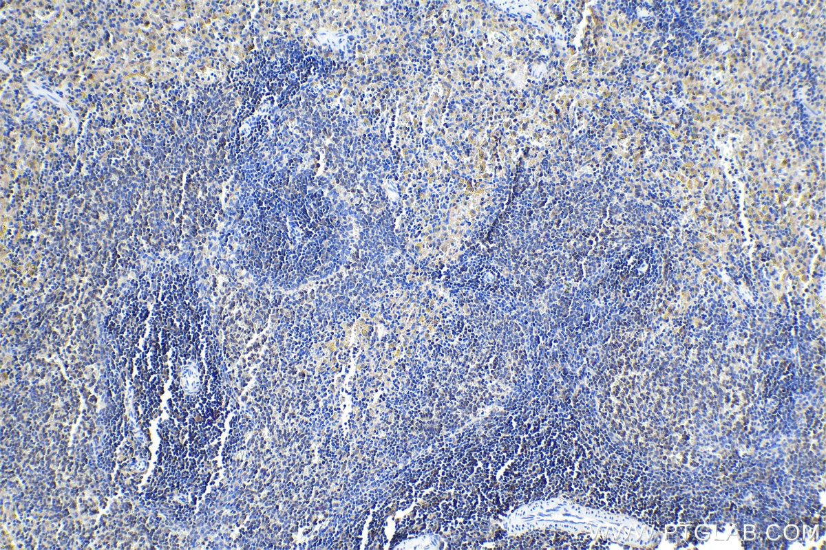 Immunohistochemistry (IHC) staining of rat spleen tissue using STAT1 Recombinant antibody (82016-1-RR)
