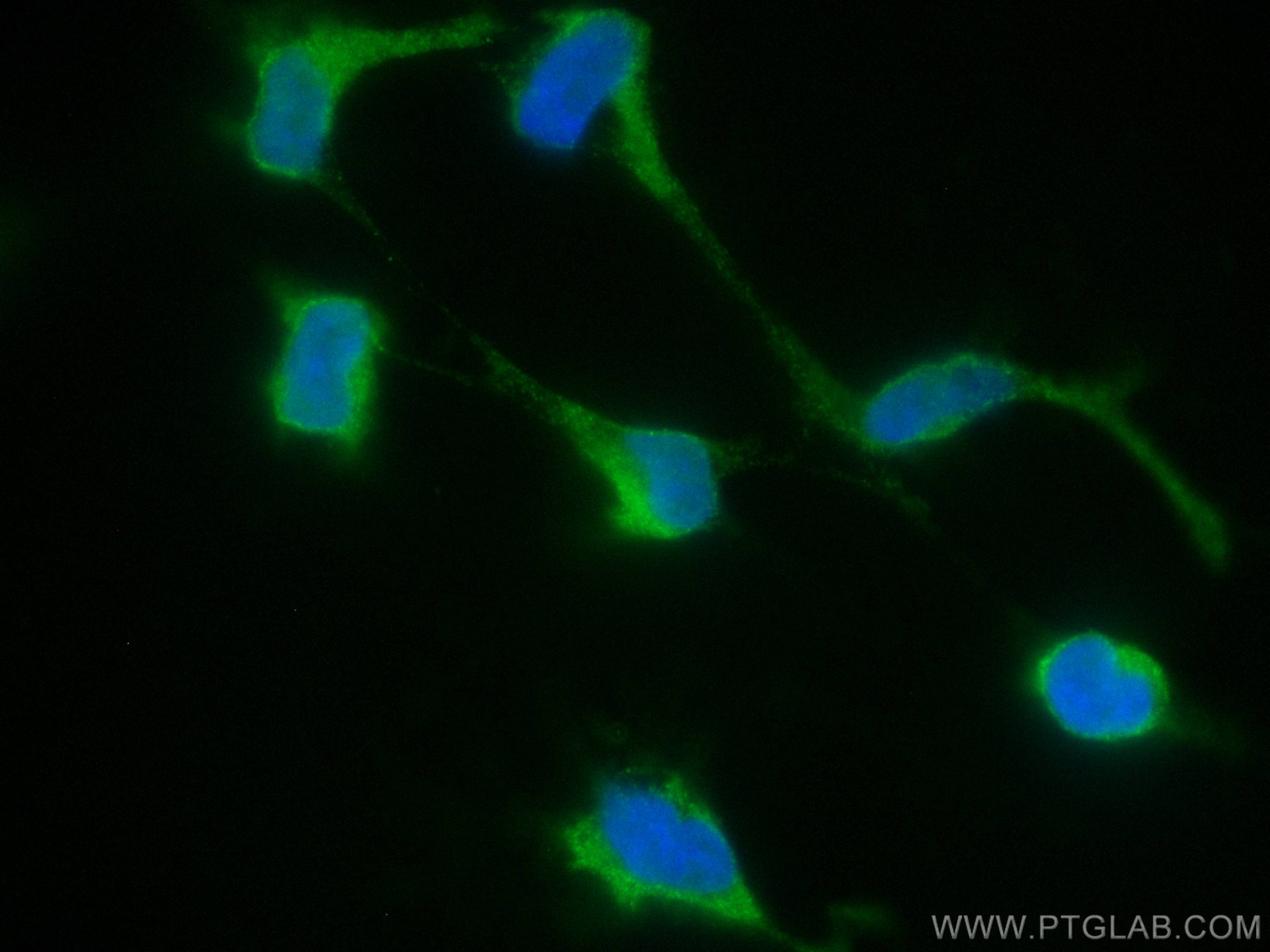 Immunofluorescence (IF) / fluorescent staining of HEK-293 cells using CoraLite® Plus 488-conjugated STAT1 Monoclonal ant (CL488-66545)