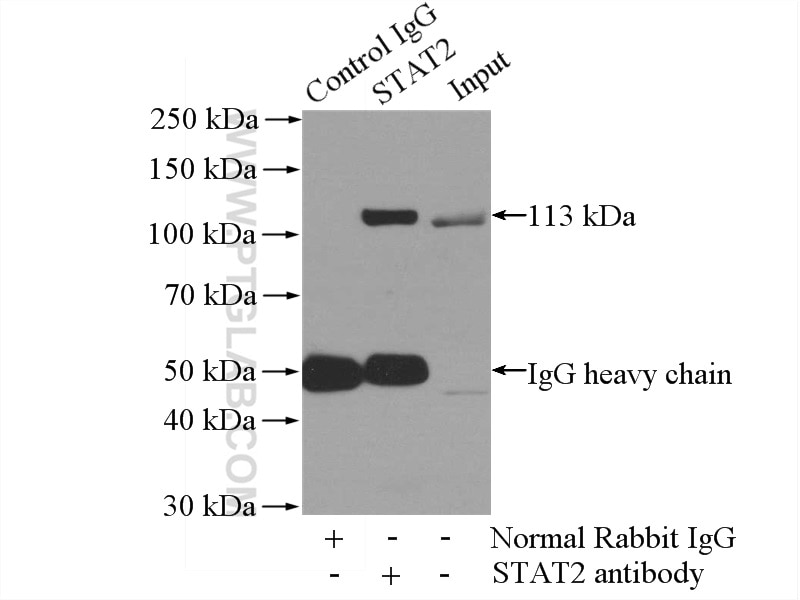 Immunoprecipitation (IP) experiment of HeLa cells using STAT2 Polyclonal antibody (16674-1-AP)
