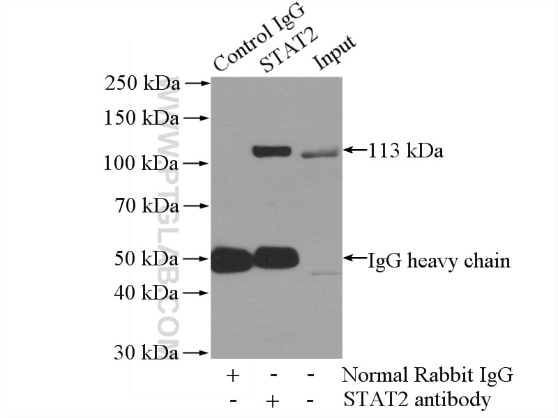 IP experiment of HeLa using 16674-1-AP