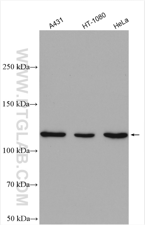 Western Blot (WB) analysis of various lysates using STAT2 Polyclonal antibody (16674-1-AP)