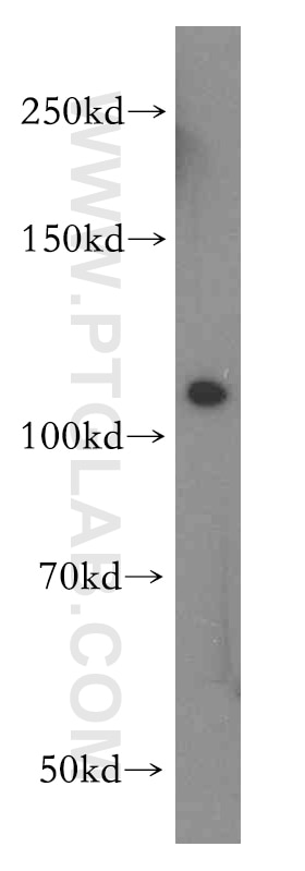 Western Blot (WB) analysis of K-562 cells using STAT2 Polyclonal antibody (16674-1-AP)