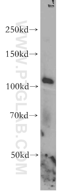 Western Blot (WB) analysis of HT-1080 cells using STAT2 Polyclonal antibody (16674-1-AP)