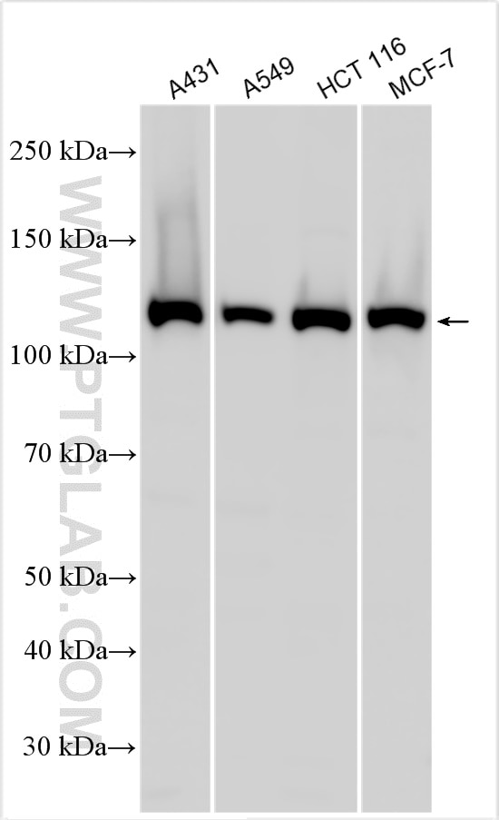 Western Blot (WB) analysis of various lysates using STAT2 Polyclonal antibody (51075-2-AP)