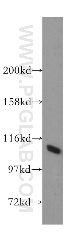 Western Blot (WB) analysis of MCF-7 cells using STAT2 Polyclonal antibody (51075-2-AP)