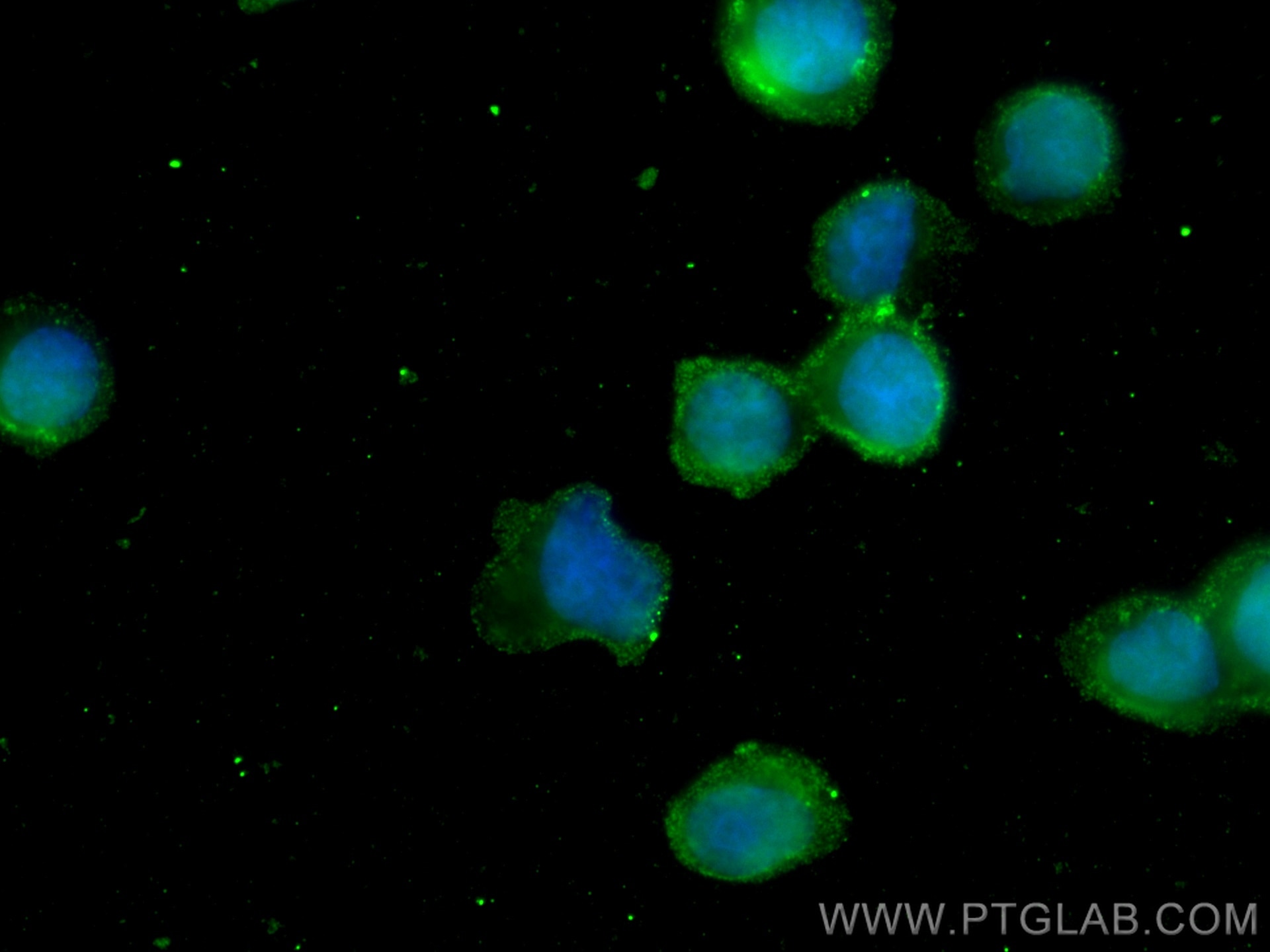 Immunofluorescence (IF) / fluorescent staining of Ramos cells using STAT2 Monoclonal antibody (66485-1-Ig)