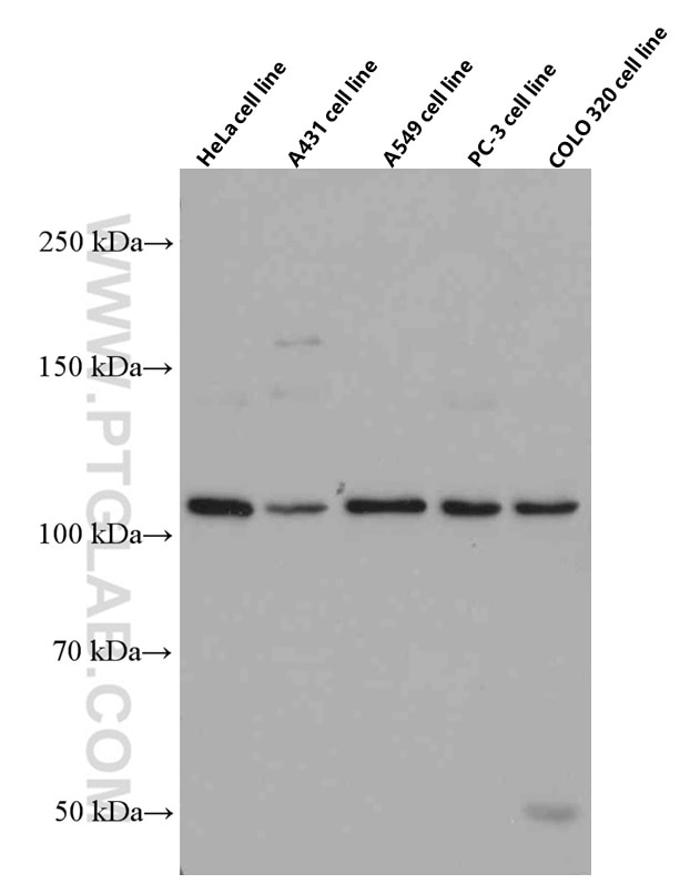 Western Blot (WB) analysis of various lysates using STAT2 Monoclonal antibody (66485-1-Ig)