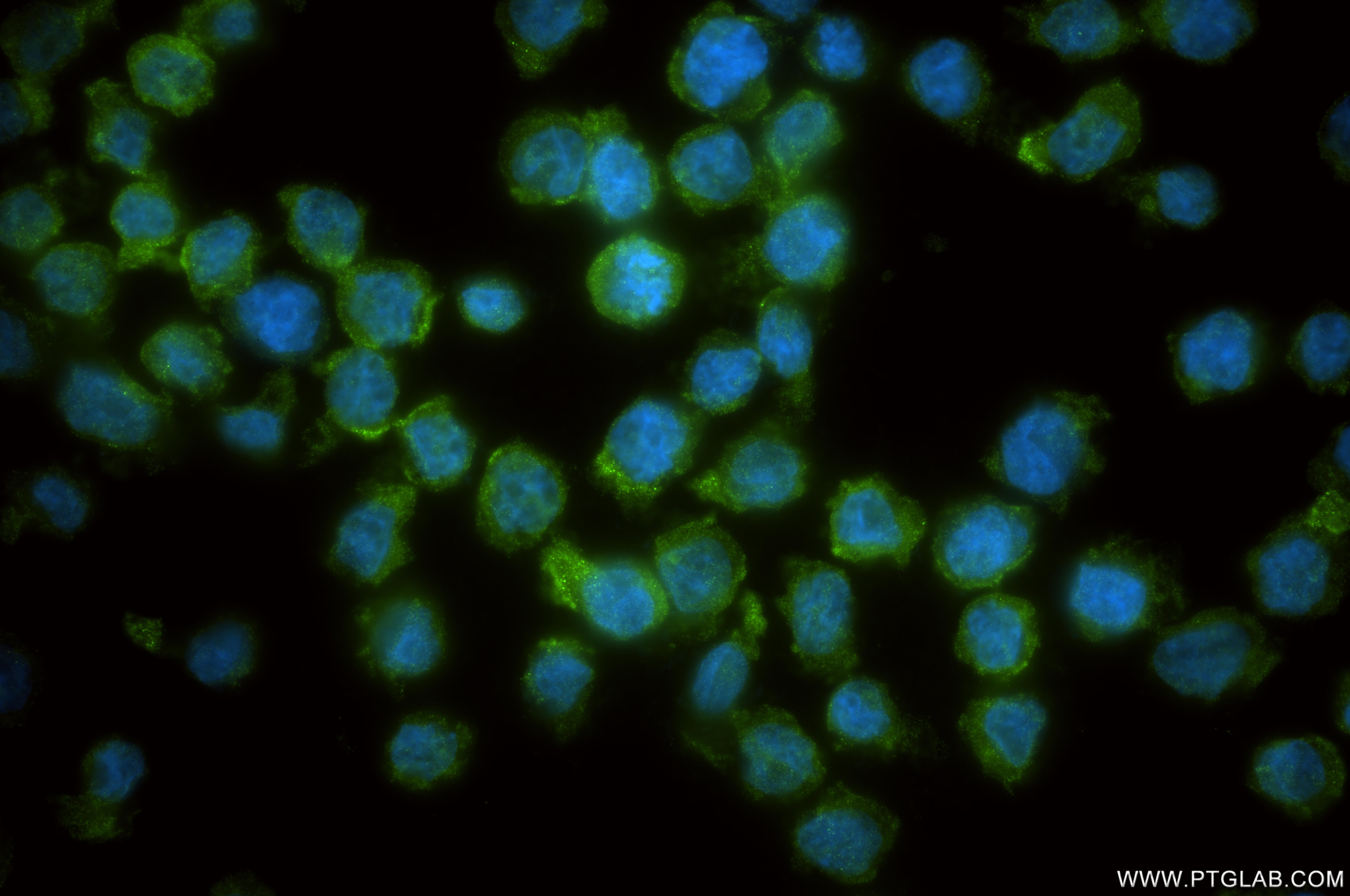 Immunofluorescence (IF) / fluorescent staining of THP-1 cells using STAT2 Recombinant monoclonal antibody (80061-5-RR)