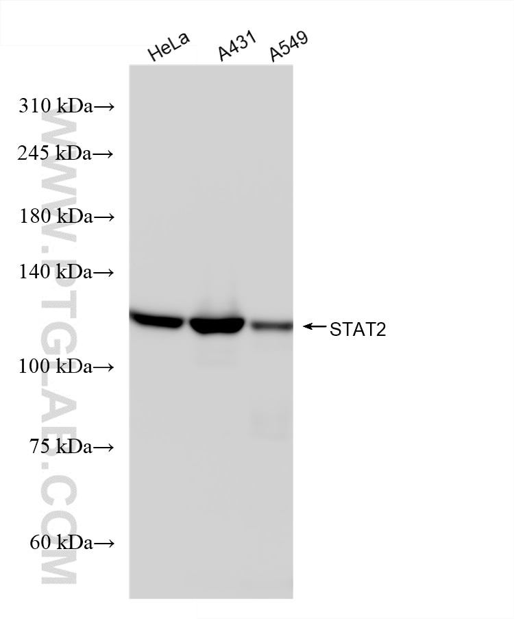 Western Blot (WB) analysis of various lysates using STAT2 Recombinant antibody (80061-5-RR)