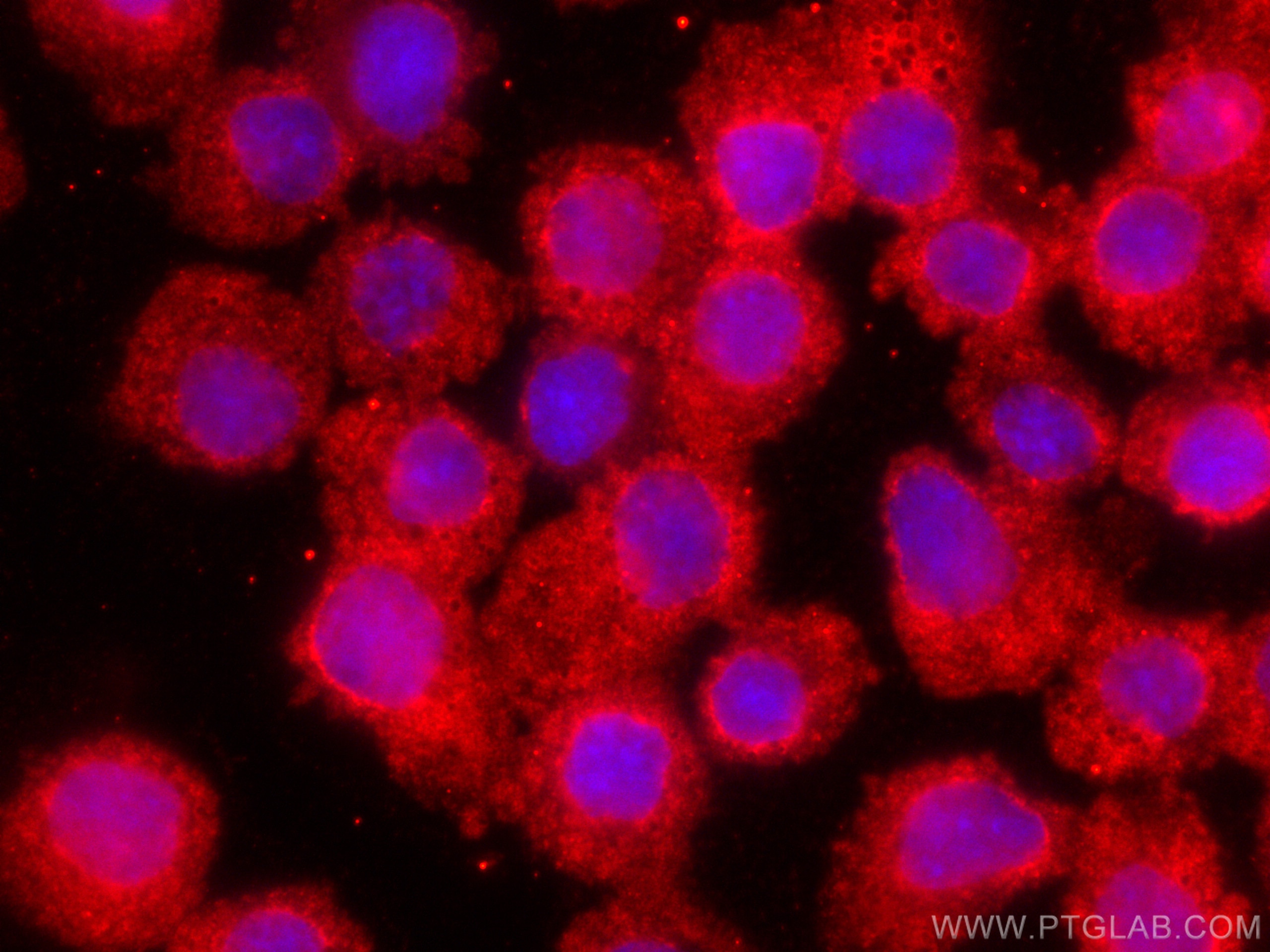 Immunofluorescence (IF) / fluorescent staining of Ramos cells using CoraLite®594-conjugated STAT2 Monoclonal antibody (CL594-66485)