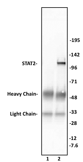 STAT2 antibody (pAb) tested by Immunoprecipitation. 10 ul of STAT2 antibody was used to immunoprecipitate STAT2 from 400 ug of HeLa whole cell extract (lane 2). 10 ul of rabbit IgG was used as a negative control (lane 1). The immunoprecipitated protein was detected by Western blotting using the STAT2 antibody at a dilution of 1:1,000.