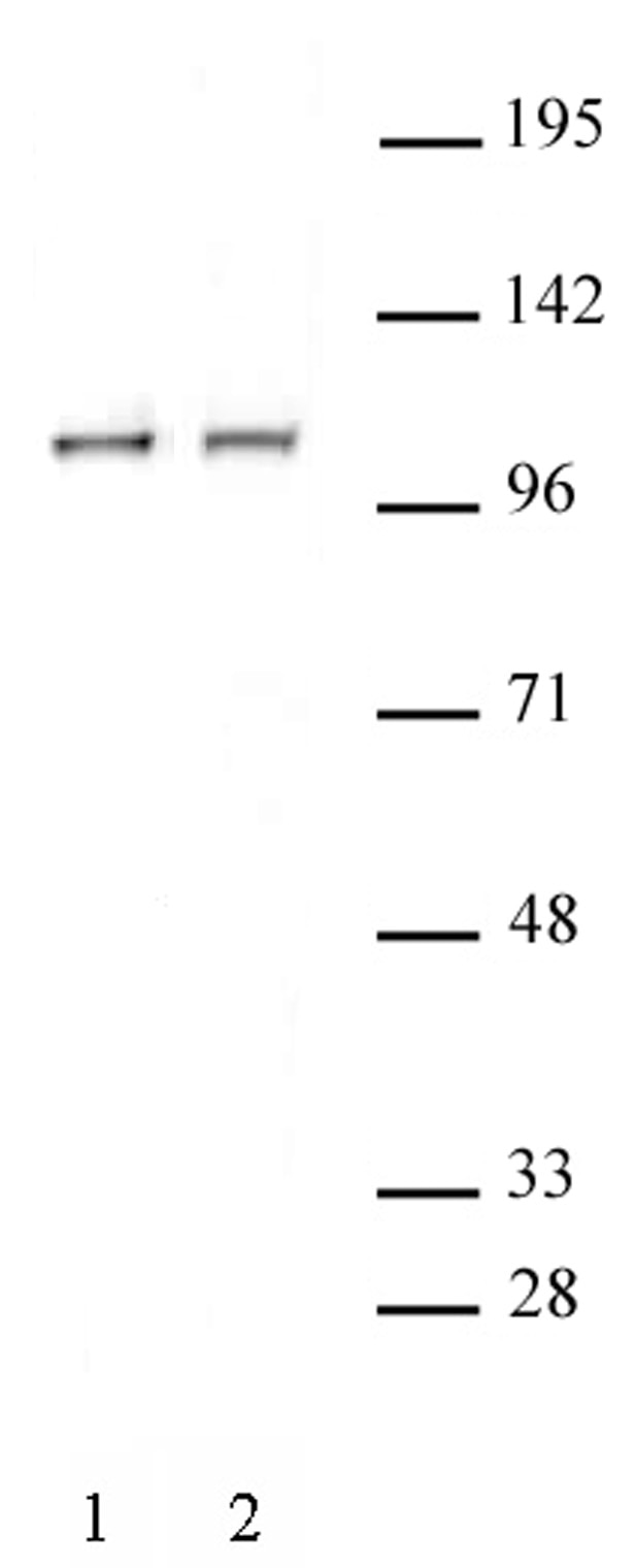 STAT2 antibody (pAb) tested by Western blot. Whole cell extract (20 ug) of Jurkat cells (Lane 1) or HeLa cells (Lane 2) probed with STAT2 antibody at a 1:1,000 dilution.