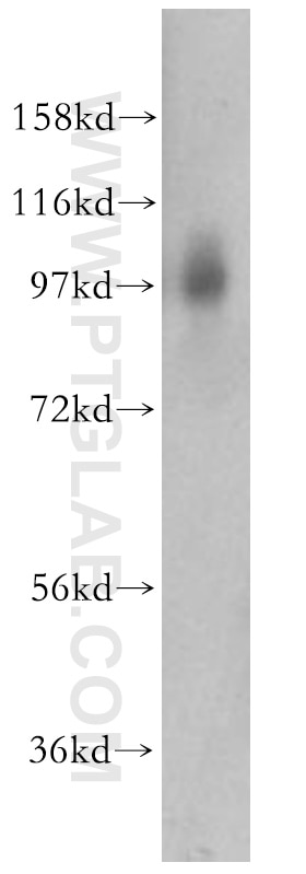 Western Blot (WB) analysis of HEK-293 cells using STAT3 Polyclonal antibody (10025-2-AP)