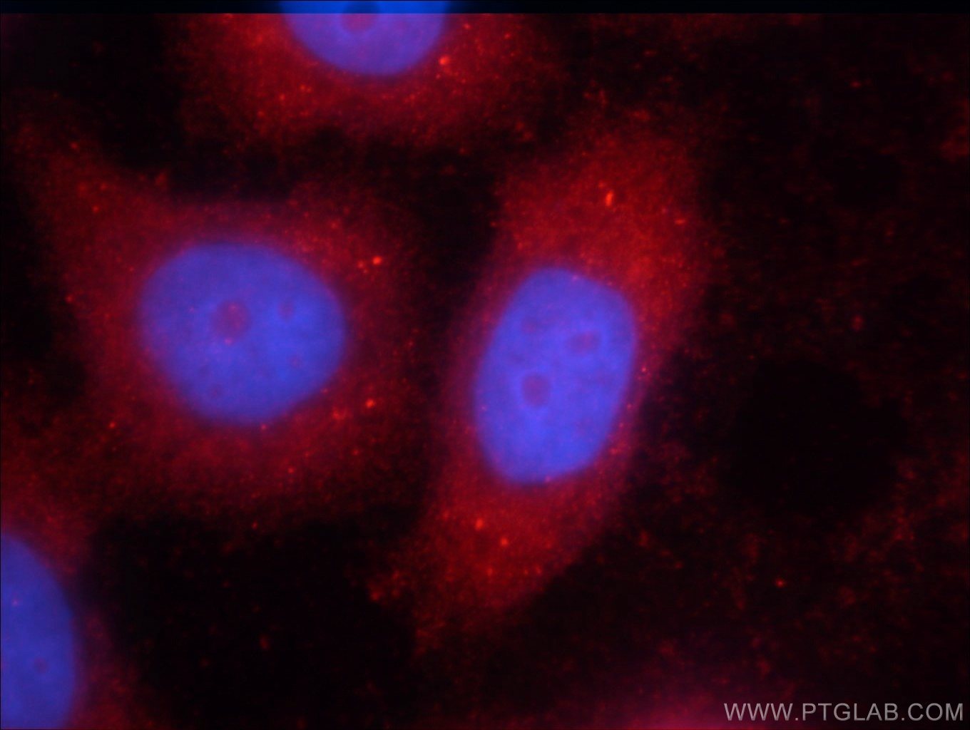 Immunofluorescence (IF) / fluorescent staining of HeLa cells using STAT3 Polyclonal antibody (10253-2-AP)