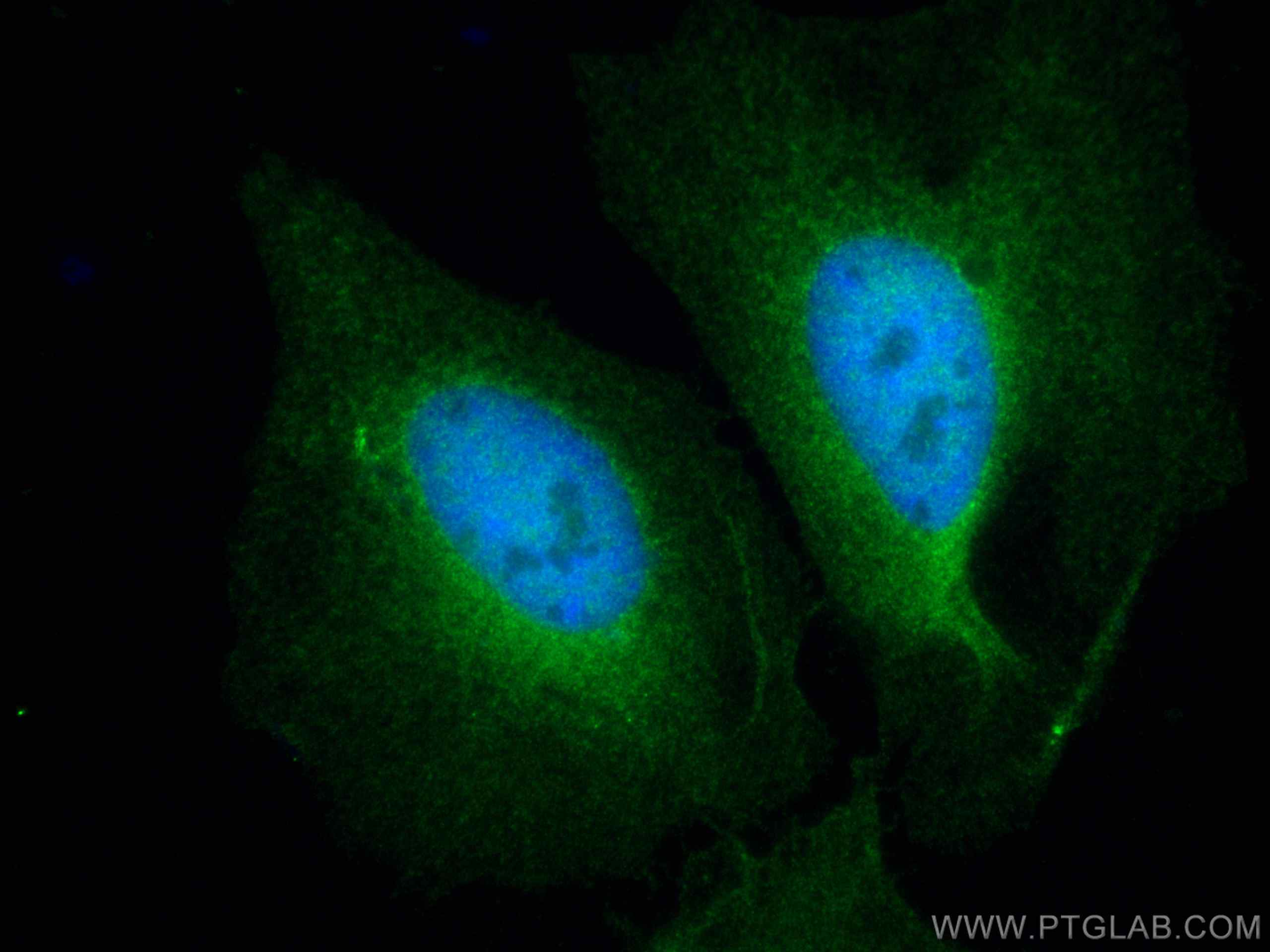 IF Staining of HeLa using 10253-2-AP