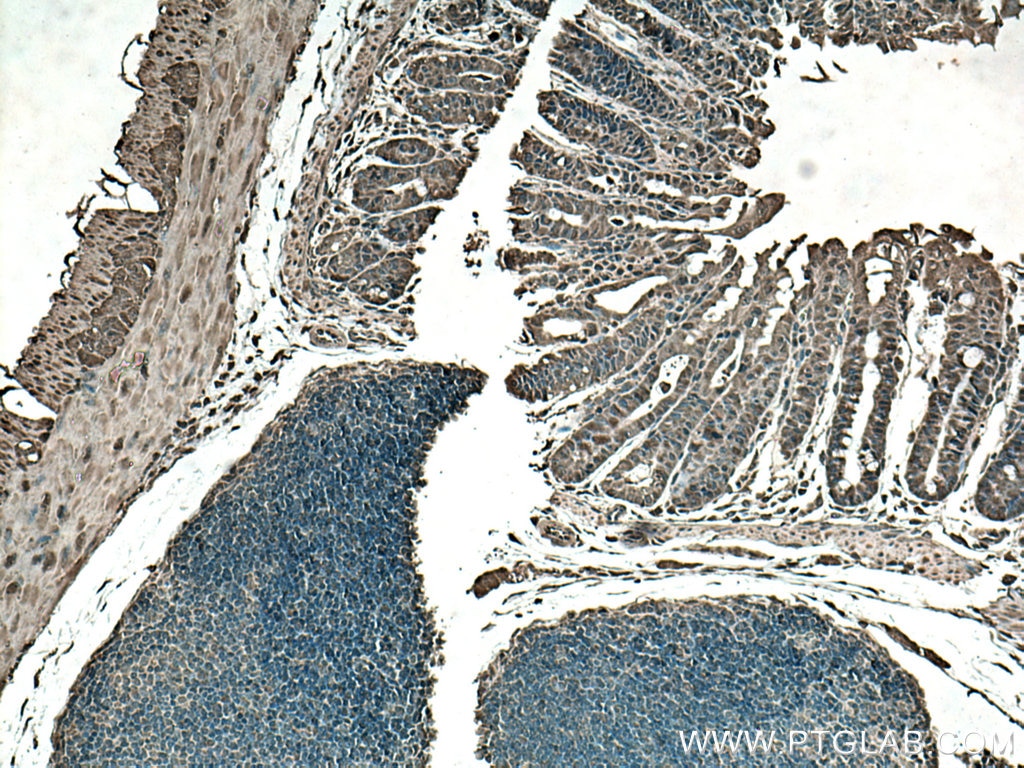 Immunohistochemistry (IHC) staining of mouse colon tissue using STAT3 Polyclonal antibody (10253-2-AP)