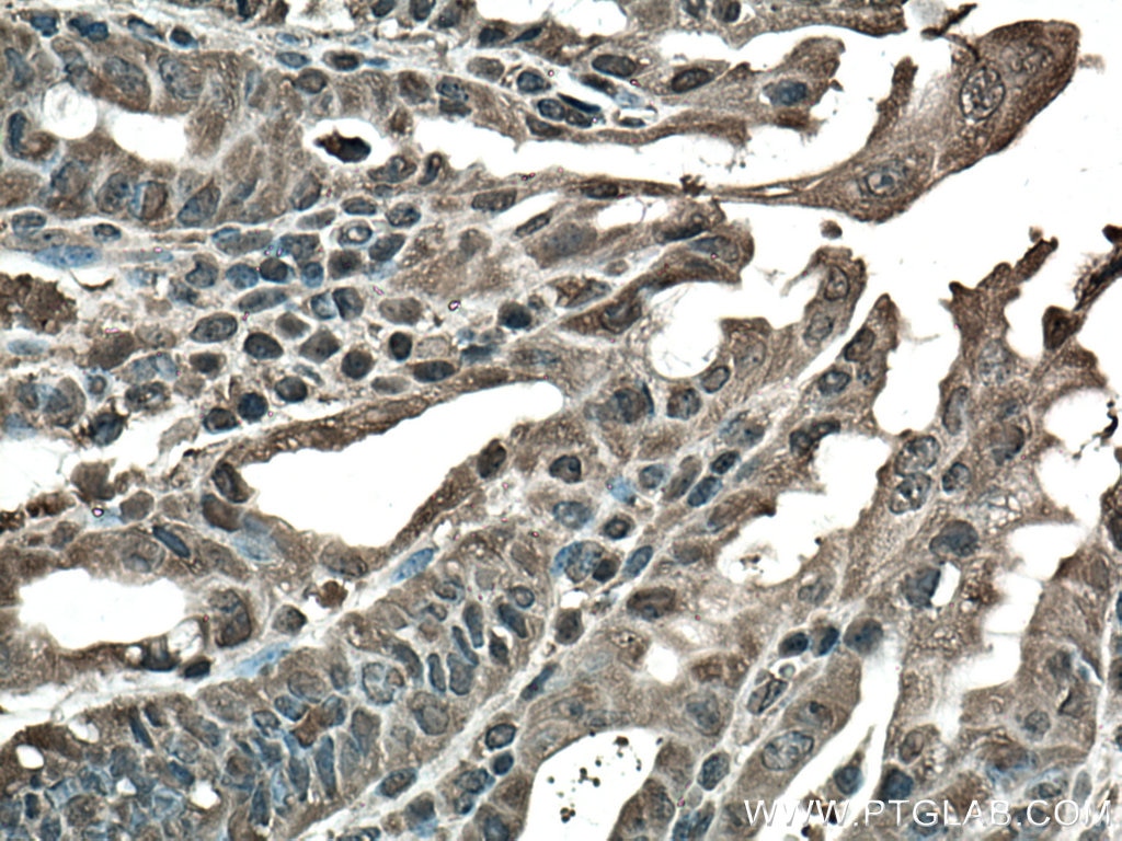 Immunohistochemistry (IHC) staining of mouse colon tissue using STAT3 Polyclonal antibody (10253-2-AP)