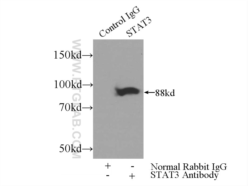 Immunoprecipitation (IP) experiment of HeLa cells using STAT3 Polyclonal antibody (10253-2-AP)