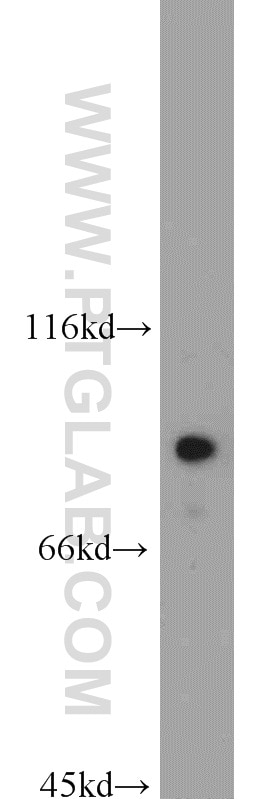 WB analysis of mouse lung using 10253-2-AP