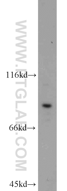 Western Blot (WB) analysis of Jurkat cells using STAT3 Polyclonal antibody (10253-2-AP)