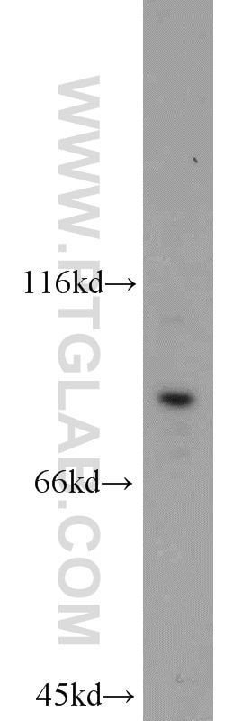 WB analysis of Jurkat using 10253-2-AP