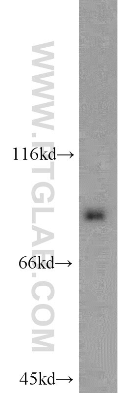 Western Blot (WB) analysis of A431 cells using STAT3 Polyclonal antibody (10253-2-AP)