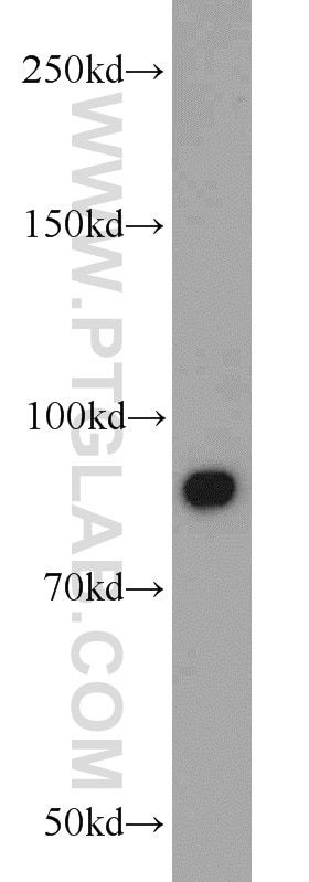 Western Blot (WB) analysis of mouse brain tissue using STAT3 Polyclonal antibody (10253-2-AP)