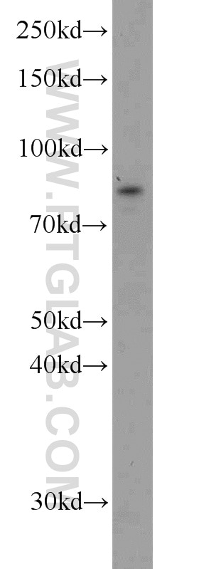 Western Blot (WB) analysis of rat brain tissue using STAT3 Polyclonal antibody (10253-2-AP)