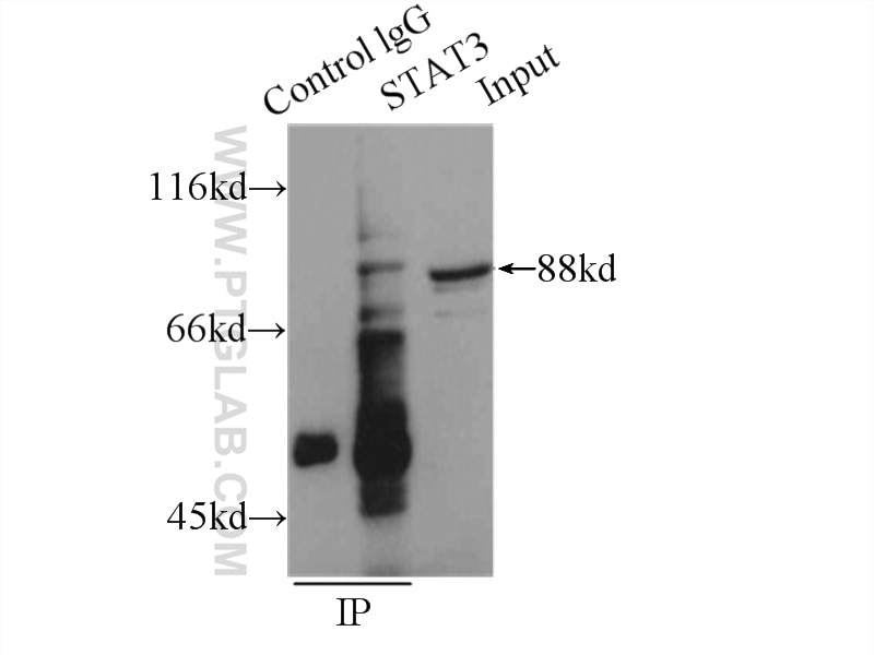 Immunoprecipitation (IP) experiment of HeLa cells using STAT3 Polyclonal antibody (51076-2-AP)