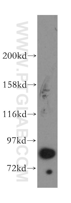 Western Blot (WB) analysis of HeLa cells using STAT3 Polyclonal antibody (51076-2-AP)