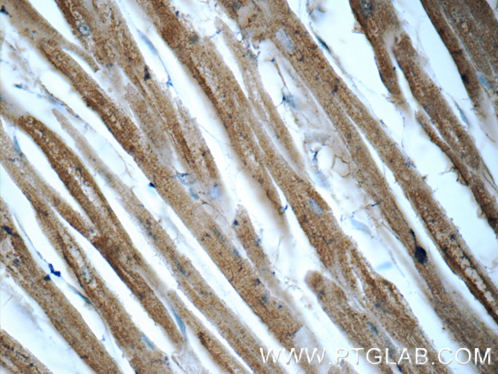 IHC staining of human heart using 60199-1-Ig