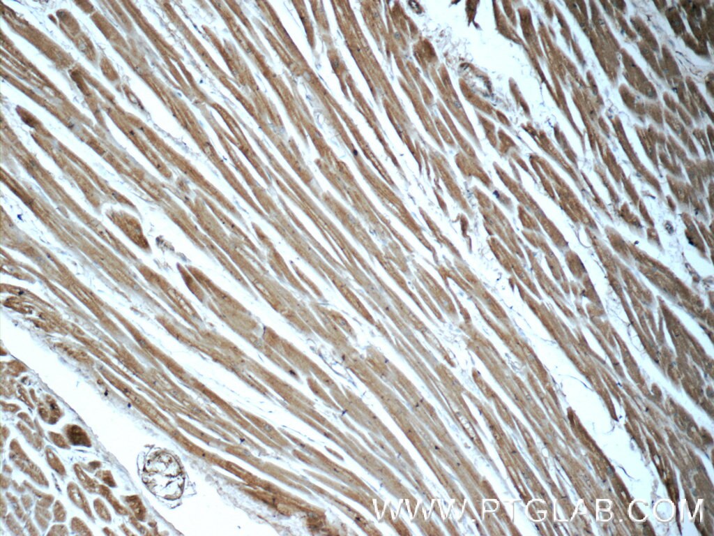 Immunohistochemistry (IHC) staining of human heart tissue using STAT3 Monoclonal antibody (60199-1-Ig)