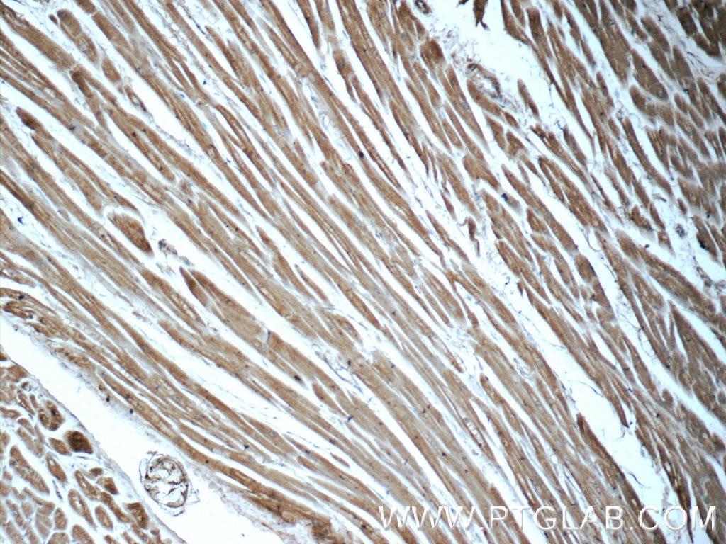 IHC staining of human heart using 60199-1-Ig