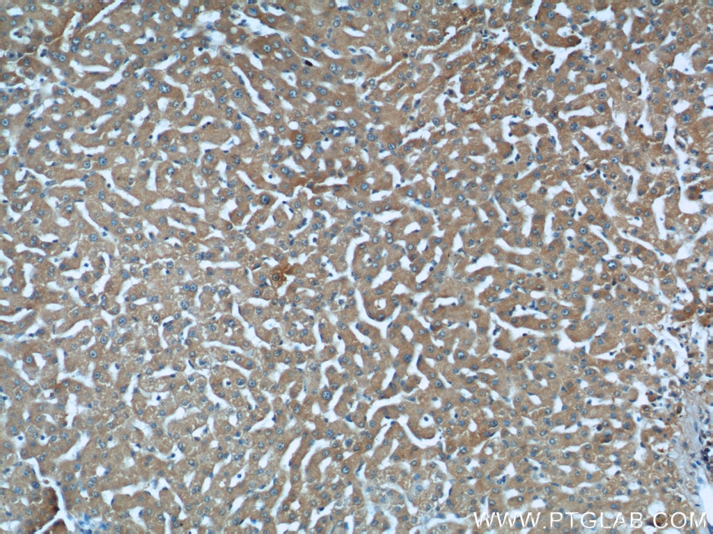 Immunohistochemistry (IHC) staining of human liver tissue using STAT3 Monoclonal antibody (60199-1-Ig)