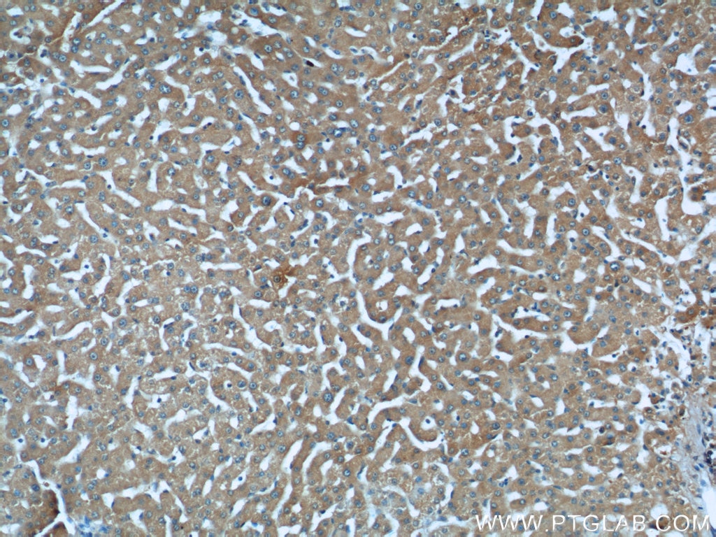 IHC staining of human liver using 60199-1-Ig