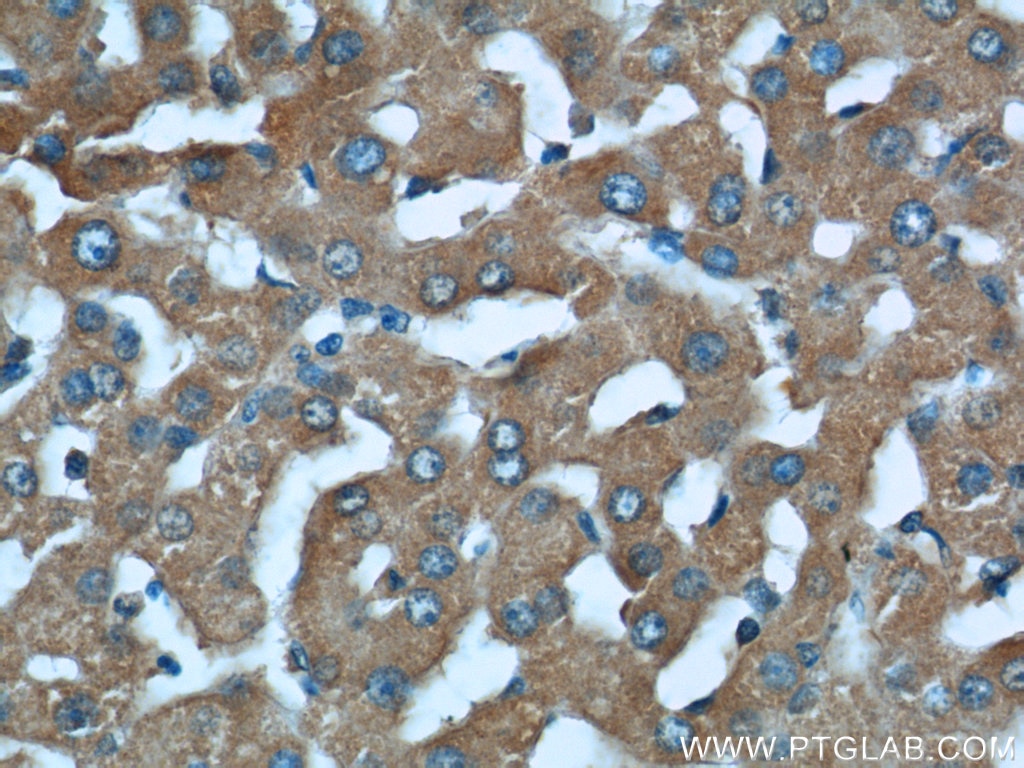 Immunohistochemistry (IHC) staining of human liver tissue using STAT3 Monoclonal antibody (60199-1-Ig)