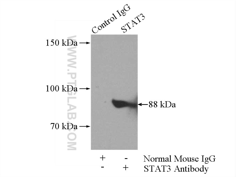 Immunoprecipitation (IP) experiment of HeLa cells using STAT3 Monoclonal antibody (60199-1-Ig)